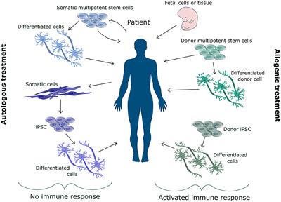 Non-immunogenic Induced Pluripotent Stem Cells, a Promising Way Forward for Allogenic Transplantations for Neurological Disorders